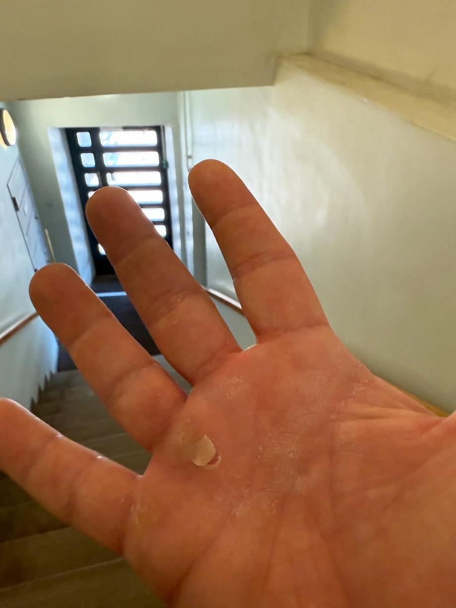 callus situation